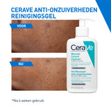 CeraVe Anti-Onzuiverheden Reinigingsgel - CeraVe - Huidproducten.nl