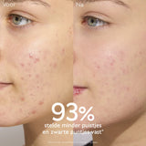 Caudalie Vinopure Fluide Anti Imperfections 40ml