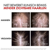 Vichy Dercos Aminexil Clinical R.E.G.E.N. Booster Serum