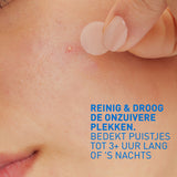 CeraVe Anti-Puistjes Patches - 22 patches