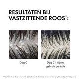 Vichy Dercos Anti-Roos DS Shampoo Navulling - 390ml - Vichy - Huidproducten.nl